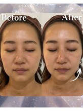 フェミューズアカサカ(FEMUSE AKASAKA)/フェイスビートダンス