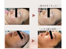 プライベートサロン 青い月