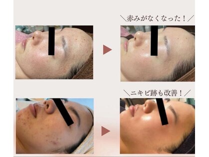 プライベートサロン 青い月の写真
