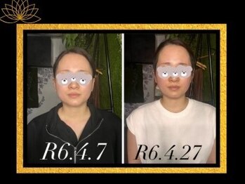 ハルハル(Haru Haru)/定期的なお手入れで・・・