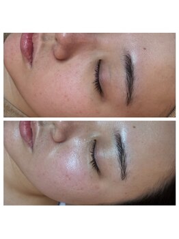 クリア 栄生(CLEAR)/【白玉リフト】LDMのみ