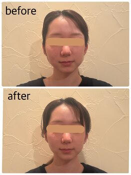 ココワ(KOKOWA)の写真/「左右差・顔の歪みが気になる方へ。やさしく整えて、すっきり美しいフェイスラインへ♪」