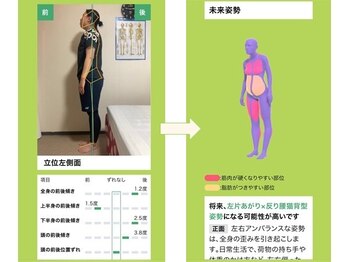 あなたにきく施術院/AI姿勢分析