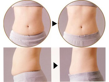 センティア アピタ岩倉店/痩身