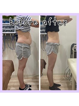 昭和区川名ひまわり接骨院/産後骨盤矯正×ダイエット【1】