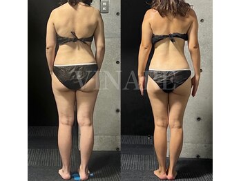ヴィナーレ(VINARE)/体重より体型 30代のお客様