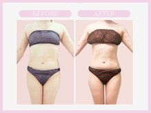 スリムライン 弘前店(The Slim Line)/before→after