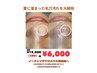 毛穴エクストラクション90分（全顔） ¥19,000→¥6,000