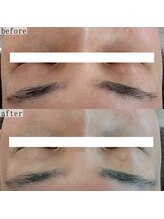 ヴェルシック(Belchic)/瞼のお悩みでご来店の方も多数