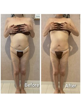 エミア(Emia)/全身痩せ×歪み改善◎120分 １回