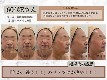 リボーン 柏(REBORN)/もたつきやすい輪郭もお任せ