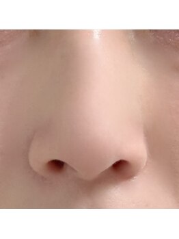 ココアイブロウ 吉祥寺(coco eyebrow)/鼻がツルツル~