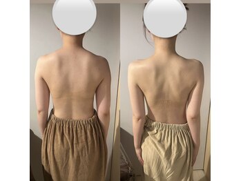 カシェット(cachette)/ウルトラ痩身