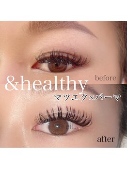 アイル(eil.)/アンドヘルシーバインドロック