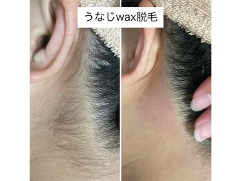 ウル(ulu)/うなじワックス脱毛