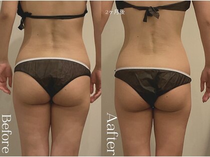 ユーフォリア グロウ(euphoria glow)の写真