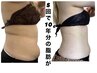 【腹筋縦線なら】硬い脂肪・しぶとい脂肪撃退♪ネオスカルプト 通常 ¥20,900 