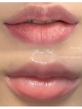 ココノワ(coconoix)/ローマピンク