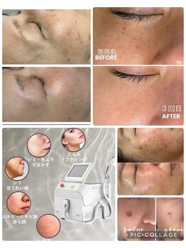 エスボーテ(sbeaute)の写真/肌本来の美しさを呼び覚ます、光フォト。