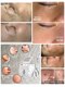 エスボーテ(sbeaute)の写真/肌本来の美しさを呼び覚ます、光フォト。