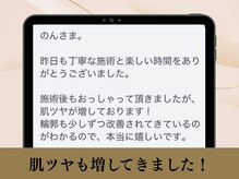 クローバー(clover)/肌ツヤも増してきました！
