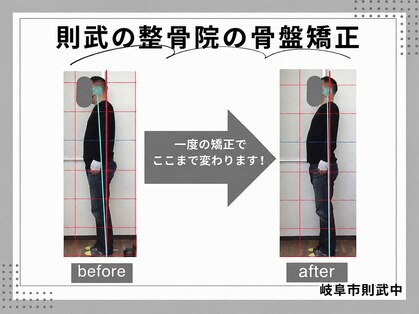 則武の整骨院の写真