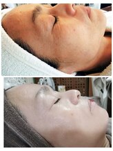 サロンドミジュ(Salon de 美jyu)/プラチナ肌質改善