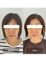 ハリオン 中目黒(HARI-ON)/初回　BeforeAfter