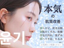 アール(R)
