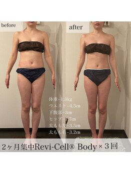 マージェ(magie)/県勇逸/認定サロンReviCell-Body