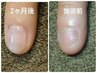 ¥8,600【ご新規様：深爪改善】ウェットケア+フィルイン*クリア