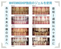 ホワイトニングショップ 一関店