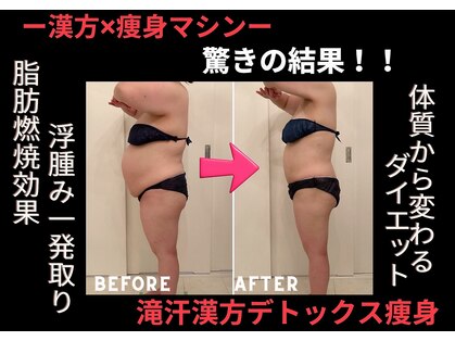 ソエルテ(soerute)の写真