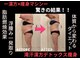ソエルテ(soerute)の写真