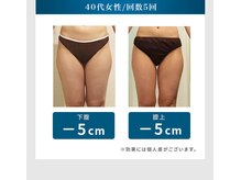 シュリット(Schritt.)/筋肉マシーン(太もも)