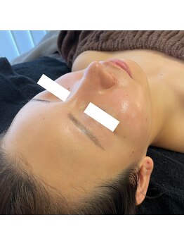 ラペカ(Lapeca)/ツルピカ肌爆誕♪お肌を光らせる