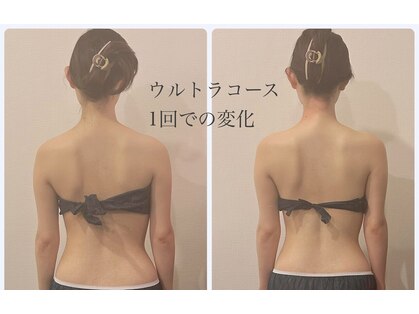 ガーレット(Garlett)の写真