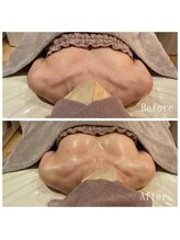 オクノマ(OKUNOMA)/【お客様BeforeAfter】
