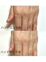 リンク(LINK)/ハンドエステ