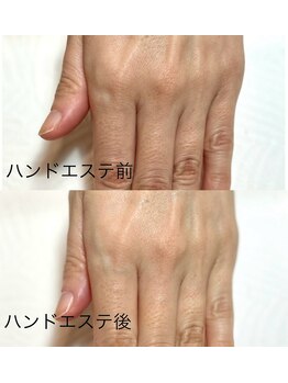 リンク(LINK)/ハンドエステ
