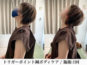 フラット(flat)/首こり・スマホ首にオススメ