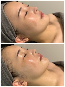 ラグ(LUXU)/超小顔術バンテージ