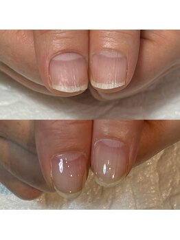 キュア(Cure.)/自爪育成ジェルで割れない爪