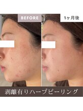 サードプレイス(3rd Place)/2階：エステ症例