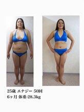 オンディーヌ 名古屋/10kg以上減もお任せください