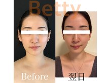 ベティ(Betty)の雰囲気（バストアップ＋小顔の同時ケアも人気♪デコルテもくっきり！）