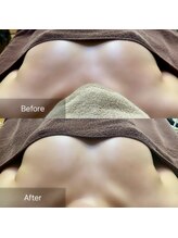 ノルン(Norn)/20代育乳バストアップ