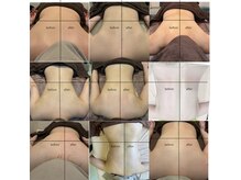 【肩こり】首肩の軽さを実感！天使の羽を取り戻しましょう♪