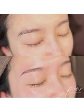 ピンキー 中野(pinky)/お顔脱毛+アイブロウメニュー