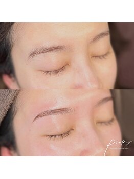 ピンキー 中野(pinky)/お顔脱毛+アイブロウメニュー